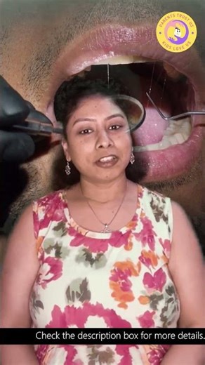 How To Know the Stages of Dental Decay, Is What Happens When you know Check the video right Now