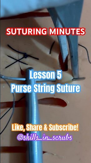 SUTURING MINUTES |LESSON 5| PURSE STRING SUTURE | Dr. Atharva Kolekar