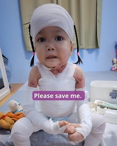 378K views · 105K reactions | Lily suffers from a rare genetic EB skin disease, and your donation will help provide the pain relief she desperately needs. Donate today to make a difference in her life! ❤️ Donate here: https://nobabyblisters.org/please-help-save-baby-lily/ | Jesus Daily | Facebook