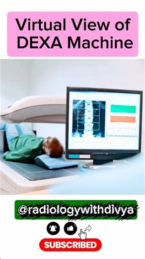 Virtual image of DEXA Machine #medical #science #healthcare #radiology #viralvideo #radiologytech