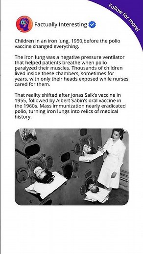 When Kids Lived in Iron Lungs Before the Polio Vaccine