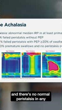 Achalasia Diagnosis - High Resolution Manometry Subtypes Explained