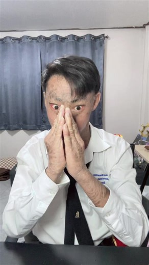 ขอบคุณทุกกำลังใจที่หลั่งไหลกันเข้ามานะครับ🙏🏻☺️❤️ #fyp #ภัทรดนัย