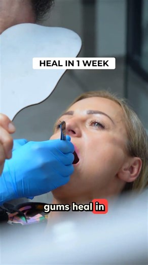 Your Toothbrush Angle is WRONG 🦷 (Why Your Gums Bleed)