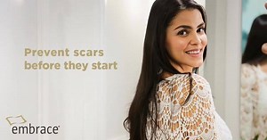 Forget the old scar treatment methods and embrace the latest scar...