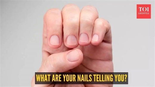 What your fingernails say about your health