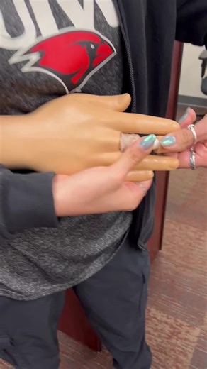 Joint_Reduction_Simulation_Lab on Instagram: "'''What are the methods used for reducing dorsal dislocation of the fingers?'''"