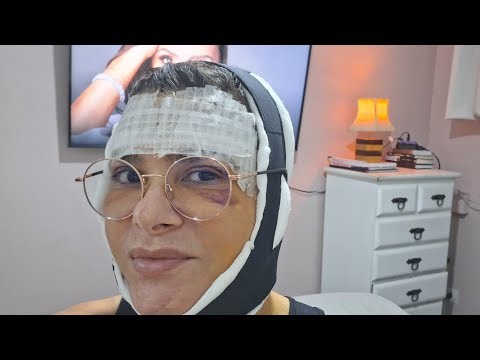 2nd Video: Facial Surgery, Santa Casa de Misericórdia RJ