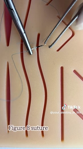 Mastering the Figure 8 Suture Technique for Med Students