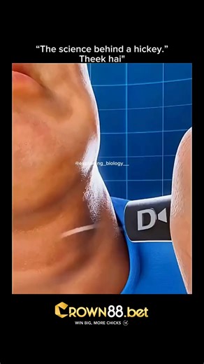 Wholesome | Motivation | Entertainment | News on Instagram: "**“A hickey isn’t just a love mark… it’s pure science happening on your skin! 🔥🧪 Jab koi area strongly suck hota hai, wahan negative pressure create hota hai. Is pressure se skin ke neeche chhoti-chhoti blood vessels (capillaries) toot jaati hain. Unme se blood bahar aa kar skin ke neeche jama ho jata hai — aur wahi ban jata hai dark purple wala deep mark… jise hum hickey bolte hain. Sabse interesting baat? Yeh mark time ke sath apna