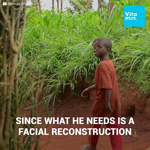 1.2M views · 14K reactions | Emanuel was born with a very different...