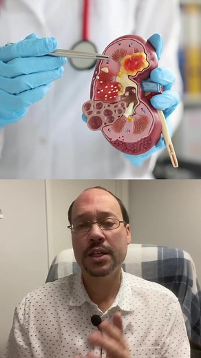 5.9K views · 100 reactions | Here’s why should seek the opinion of multiple Nephrologist if you have Kidney Disease #kidneydisease #health | Healthy Kidney Inc. | Facebook