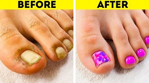 Incredible feet transformations. Pedicure and manicure ideas: | 5-Minute Crafts GIRLY