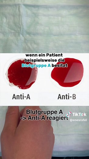 Bluttransfusion in der Klinik: Alles was du wissen musst