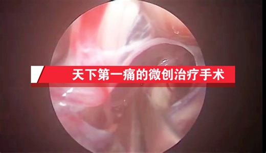 天下第一痛三叉神经痛的最好的治疗方法
