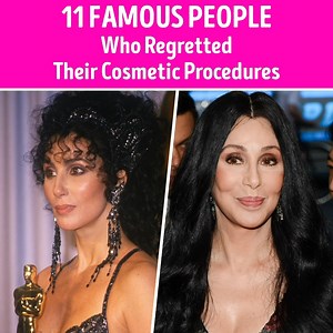 112K views · 461 reactions | 11 Famous People Who Regretted Their Cosmetic Procedures | CelebRatings | Facebook