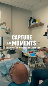 A broken file inside the root canal? 😬Sounds scary… but in the right hands, it’s manageable.