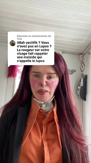 Réponse à une question sur le lupus