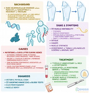 Rippling Muscle Disease: What Is It, Signs, Symptoms, and More | Osmosis