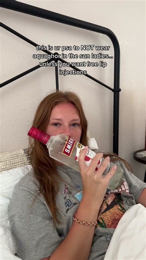Aquaphor for Sunburn Relief