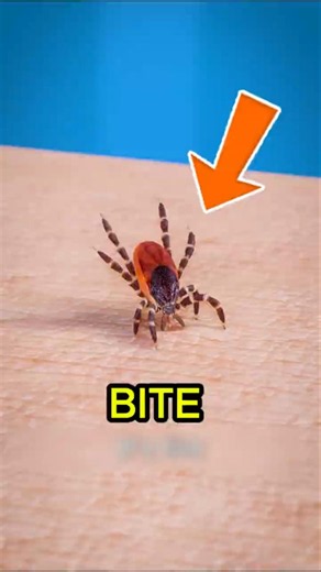 ⚠️ Never Remove a Tick Like This! The Dangerous Mistake Most People Make