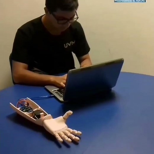 Prótesis robótica impresa en 3D controlada con Arduino y sensor muscular mioeléctrico