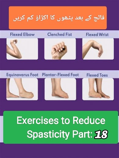 One Stretch to Relieve Whole Body Spasticity