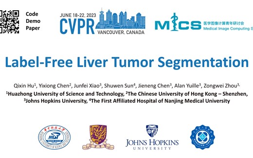 【36】Label-Free Liver Tumor Segmentation