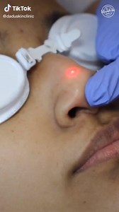 23 reactions | Freckles are one of the most common forms of...