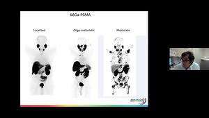 Prostate Cancer Imaging Updates: What, Why, and When
