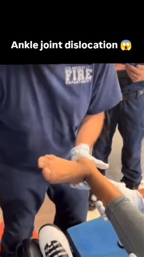 Kumar Niel | 💥 Subtalar joint dislocation 💥 . . . @physiopathwayy . . . . #physiopathway2025 #physiopathwayy #physiotherapymanagement... | Instagram