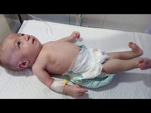 "Newborn Baby Diagnosis Sepsis | NICU Admission Initial Assessment & High Fever Care | Male Nurse"