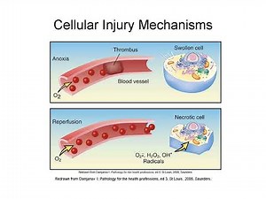 Cellular Injury and Adaptation Explained: Atrophy, Necrosis, and Apoptosis