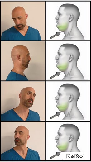 4 simple exercises to reduce a double chin