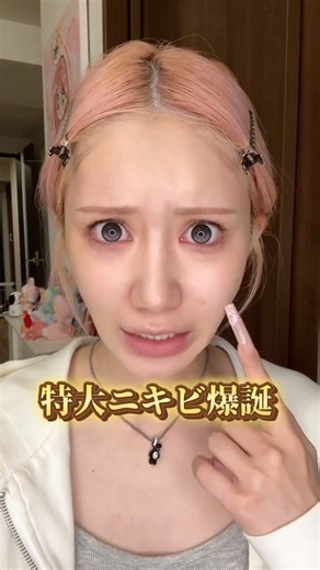 GOTO SHIZU on Instagram: "大事な日の前に 特大ニキビ爆誕するのってしづだけ？！ そんな緊急事態🚨に備えて 1人ひとつはストックとして 持っておいてほしいitem 【 Snow2plus/ACマグネシウムパッチ 】 オリヤンで1位に なったこともあるくらい ニキビパッチといえばこれ‼️ なやーつです🫡🪽✨ 肌荒れをケアしながら 保護もしてくれるから 早急に消し去りたいニキビさんには このパッチを使うが吉。 なんとこの度メガポ期間中に 初❕コラボをさせていただけることに🐈🥃💛ありがとーございます 期間中にお得にゲットしてねん💝 #PR#スノーツープラス#Snow2plus #ACマグネシウムパッチ#ニキビパッチ #トラブルパッチ#ニキビケア#メガポ #Qoo10"