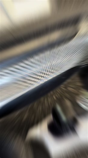 Finding the Perfect Prosthetic Socket