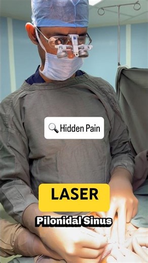 🔥 Tailbone Se Pus Aa Raha Hai ? Pilonidal Sinus Ka Permanent Solution! ⚡️Laser treatment Surgery