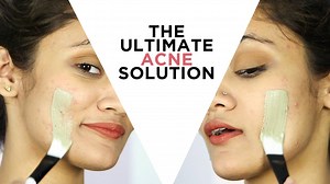 Aztec Secret Indian Healing Clay Mask... a perfect product for deep pore cleansing. It's a great choice of getting a beautiful and smooth skin by preventing pores and acne problems of skin. You can use this through different ways. Let's know more detailed about it. To buy this product click the link mentioned below- http://shop.shajgoj.com/aztec-secret-indian-healing-clay.html | shop.shajgoj.com