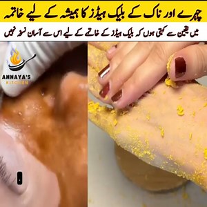 How To Remove Black Heads & White Heads For Face #blackhead #whitehead #openpores #beautytips #skincareroutine #skin #remedy #homeremedies #foryou #fyp #viral #foryoupage #tiktok | Dr Health Tips