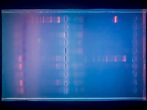 ¿Qué es la PCR y para qué se utiliza? - iDescubre