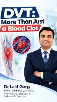 DVT: More Than Just a Blood Clot — Know the Risks, Symptoms & Treatment Options