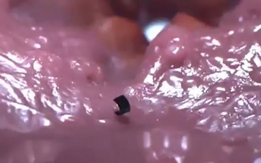 全球最小的磁控机器人，像虫子一样运动，可以在人体内行走