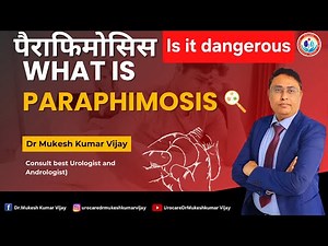 WHAT IS PARAPHIMOSIS IS IT DANGEROUS ? Dr Mukesh Kumar Vijay