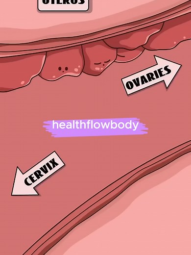 Understanding How Chocolate Cysts Are Formed