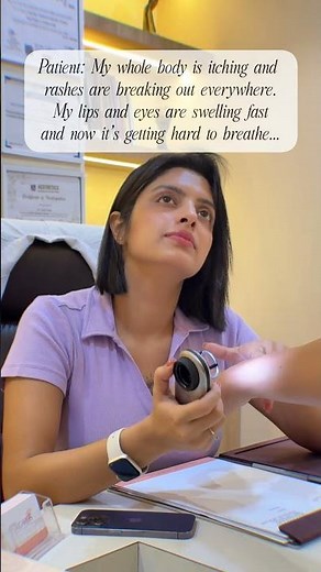 ⚠️ A classic case of acute allergic reaction ( Urticaria with Angioedema) #dermatology #skinallergy