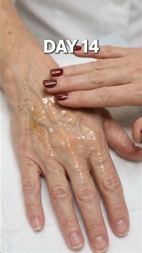 Paper-thin crepey skin and dark sun spots on my hands completely smoothed by Day 60! This serum made