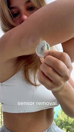 Removing My Diabetes Freestyle Libre Sensor