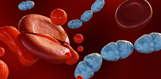 Post-sepsis syndrome: when the body recovers but the brain doesn’t