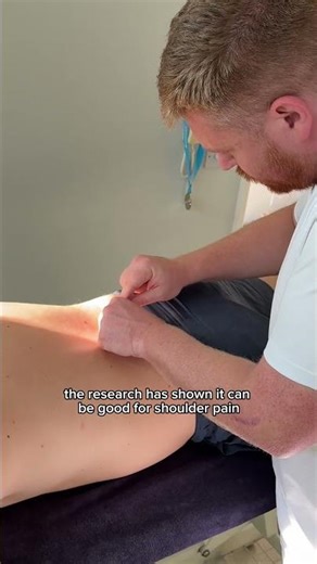 Matt explains how acupuncture works 👀