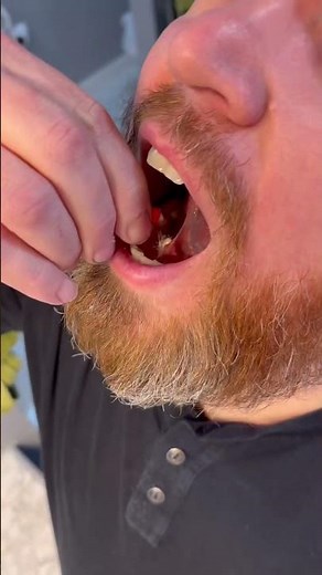 DEMO: Semaglutide sublingual adminstration